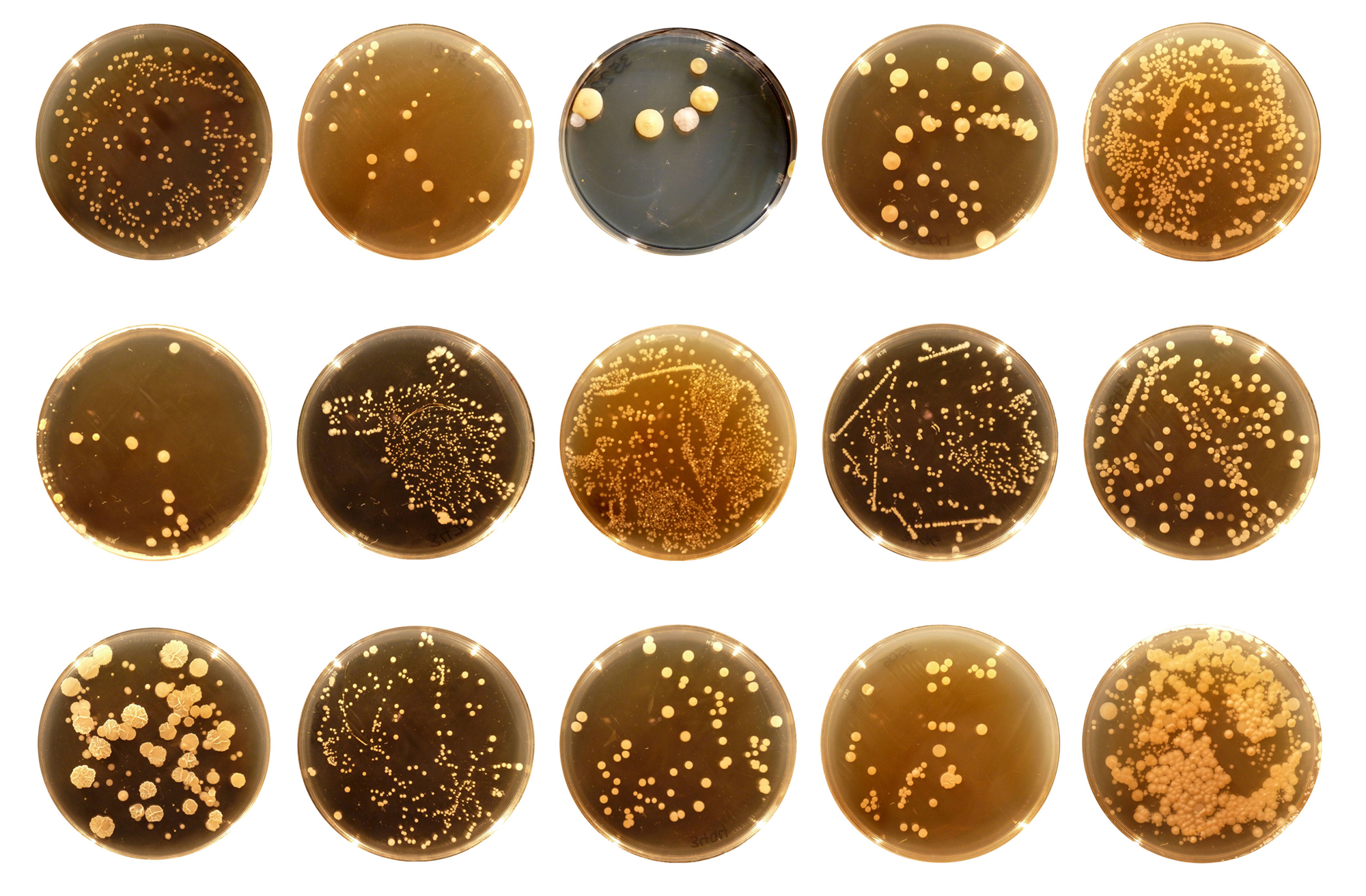 Researchers have identified more than 2,000 species of microbes -- a few of which are pictured here -- that live in human bellybutton habitats, as part of the Belly Button Project. Image: Neil McCoy, Rob Dunn Lab.